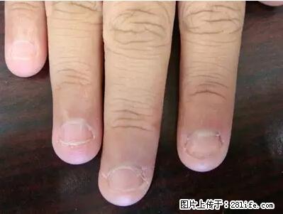 剪指甲、挖耳屎，这些日常小动作竟隐藏大危害！ - 娄底生活资讯 - 娄底28生活网 ld.28life.net